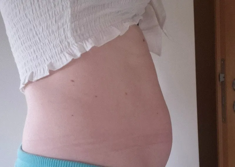 Rektusdiastase Training nach 1 Woche
