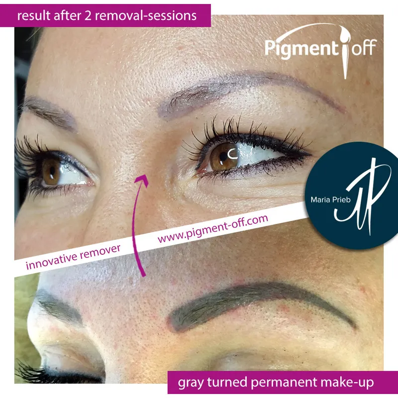 Entfernung und Korrekturen von altem Permanent Make-up