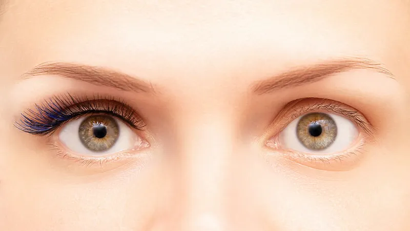 Gehen nach der Entfernung der verlängerten Wimpern fast alle Eigenwimpern verloren ?