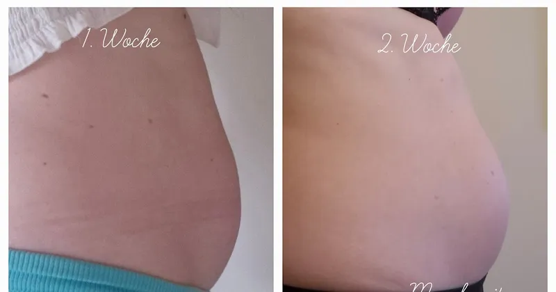 Rektusdiastase Training - Woche 2