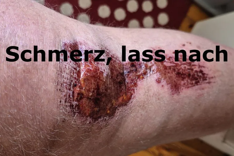 Schmerz, lass nach