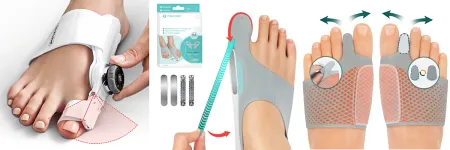 Hallux Valgus: Was ist besser, orthopädische Einlagen oder Schuhe?