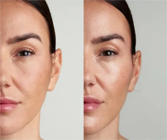 Glass Skin Effekt – ein neuer Trend in der Beauty-Branche