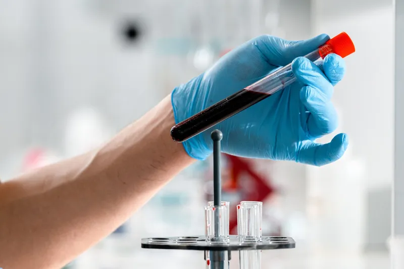 Wie lange ist Alkohol im Blut nachweisbar? Abbau und Alkoholmarker erklärt